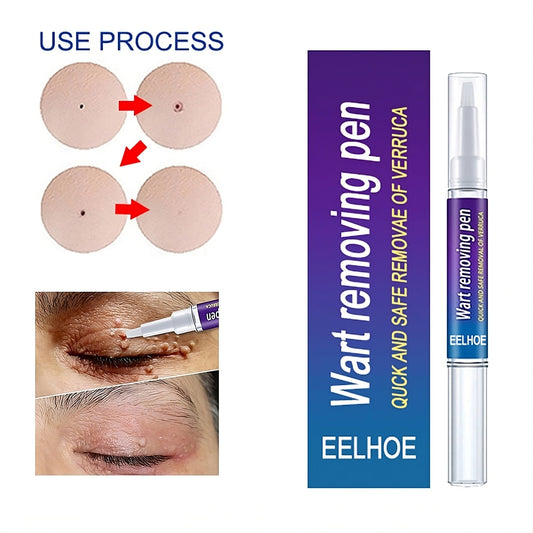 Skin Wart Removing Pen - Miraaj